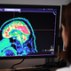A doctor looking at a picture of a human brain taken by a positron emission tomography scanner, also called PET scan, on Jan. 9, 2019, at the Regional and University Hospital Center of Brest in France.